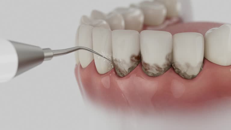 Trusted Emergency Dentist service in Cypress Lake, FL - Dentist Open Now